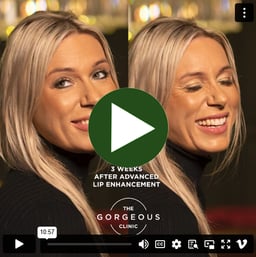 watch videos of happy clients from the gorgeous clinic