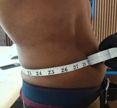 Fat dissolving client after resutls, reduced waist measurement