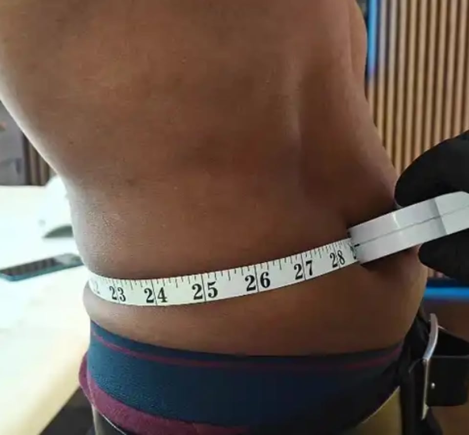 Fat Dissolving (AQUALYX)