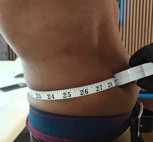 Our client booked in for 3 sessions of fat dissolving injections in his lower abdomen and flanks based on our clinicians recommendation. 

Below are the results he achieved, when combining the treatment with a healthy water intake and moderate, consistent exercise to aid in the removal of the dissolved fat cells. 

Waist Measurements:

1 month after 1st session: 33.8"
1 month after 2nd session: 31.2"
1 month after 3rd session: 29"

Our client lost an incredible 4.8" from his waist, and this wasn't even the final result - swelling and inflammation was still present. 

This was all with a non-surgical, 45 minute procedure once a month